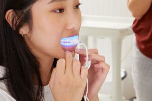 Top 8 Best Teeth Whitening Products For A Brighter Smile
